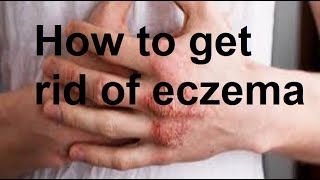 Effective Remedies for Eczema [upl. by Evelyn]