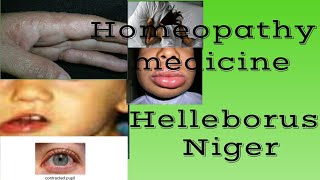 Helleborus Niger Homeopathy medicine in hindi by Premwati Yadav [upl. by Femmine]