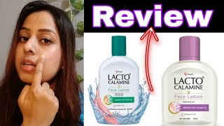 Lacto Calamine face Lotion Review  How To Use lacto Calamine Lotion skfashionlifestyle [upl. by Idna]