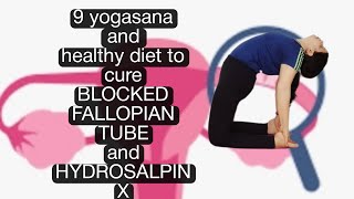 Diet and 9 yogasan to cure Blocked Fallopian Tube and Hydrosalpinx [upl. by Nwahsit]