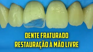 Restauração de dente fraturado em sessão única  Técnica a mão livre [upl. by Yelnet]