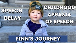 APRAXIA OF SPEECH  CHILDHOOD APRAXIA OF SPEECH [upl. by Nicolas]