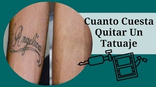 Cuanto Cuesta Quitar Un Tatuaje Como Borrar Un Tatuaje En Casa Como Borrar Un Tatuaje Sin Laser [upl. by Idette]