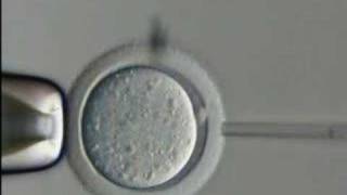 Embryonic Stem Cells and Disease Part 2 of 6 [upl. by Tristan223]