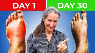 17 Years of Swollen Legs amp Feet Gone in 9 Hours Dr Barbara ONeills SHOCKING HIDDEN Discovery [upl. by Rowena]