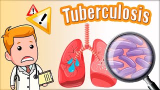 🔴🔴 TUBERCULOSIS TB síntomas diagnóstico Mantoux y tratamiento Mycobacterium tuberculosis [upl. by Yrod]