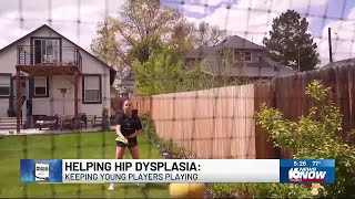 Medical Moment Helping hip dysplasia [upl. by Dorahs]