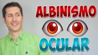 🔴👀 Albinismo ocular  Una condición rara [upl. by Denna]