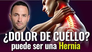 ¿DOLOR DE CUELLO Puede ser una Hernia [upl. by Wilson]