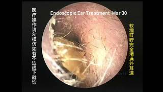 Exploring the causes and treatment methods of ear itching and stuffiness [upl. by Anialahs657]