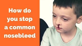 How To Stop A Nosebleed Dos and Donts [upl. by Anitsrik391]