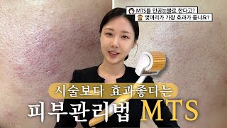 요즘 핫한 셀프MTS 부작용은 없는데 효과 배로 보는법 [upl. by Donella]