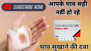 घाव सुखाने की दवाCiprofloxacin 500mg use ciprofloxacin hydrochloride helthptipsciplox [upl. by Shaw]