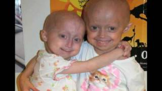 PRF  Progeria clinical drug trial [upl. by Callida]