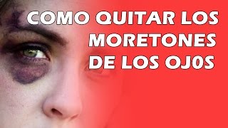 Como Quitar Los Moretones De Los Ojos [upl. by Luane]