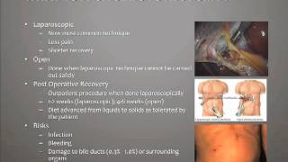 What is a Cholecystectomy [upl. by Lottie]