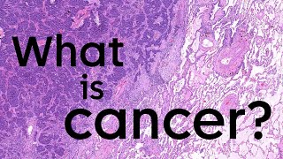 What is cancer and how does it start  Cancer Research UK [upl. by Jamima]