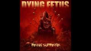 In the Trenches  Dying Fetus [upl. by Peedsaj888]