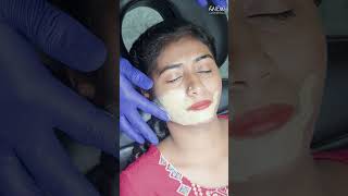 COSMELAN PEEL to treat hyperpigmentation [upl. by Ssilem]