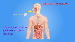 Barium Swallow [upl. by Dickinson34]