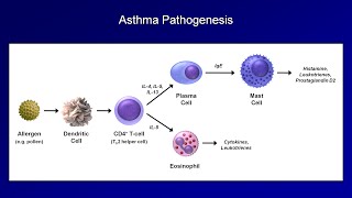 Asthma and COPD  Pathogenesis and Pathophysiology [upl. by Noyes]