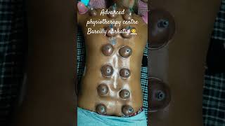 back treatmentcupping therapyphysiotherapyandrehabilitation youtubeshorts bareilly apc ❤️ [upl. by Aisset]