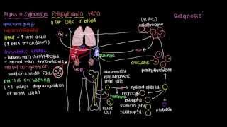 What is polycythemia vera [upl. by Gaulin]