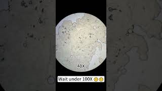 Pork heart magnified 400X is so cool underthemicroscope microscope scienceshorts [upl. by Ignazio]