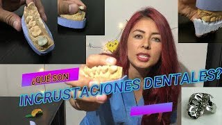 INCRUSTACIONES DENTALES QUE SON LAS INCRUSTACIONES DENTALES [upl. by Kendrah]