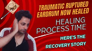 My Ear Drum RupturedPerforated  My traumatic eardrum hole repaired without surgeryTechism Info [upl. by Hayley426]