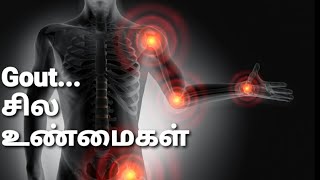 Goutசில உண்மைகள்  goutarthritis [upl. by Souza215]