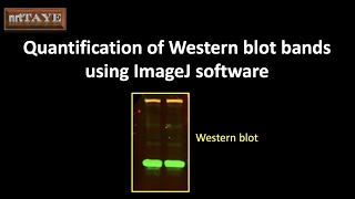 Quantification of Western blot bands using ImageJ software [upl. by Stolzer]