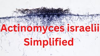 Actinomyces israelii Simplified TRICK [upl. by Hachmann308]