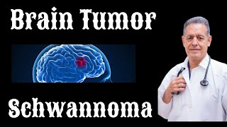 Brain Tumor  Schwannoma Diagnosis Treatments Prognosis and Survival rate [upl. by Esirehs]