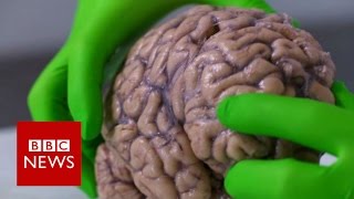 Up close with a human brain  BBC News [upl. by Alvita]