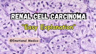 Renal cell carcinoma  Renal pathology mediumrobbins emotionalmedico [upl. by Elon]