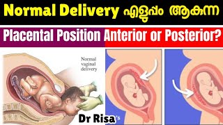 പ്രസവം എളുപ്പമാകുന്ന Placental Position  Anterior amp Posterior Placenta [upl. by Player]