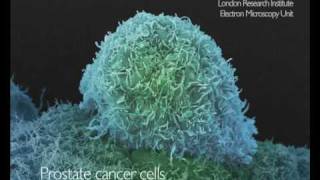 Electron microscopy of cancer cells from Cancer Research UKfunded scientists [upl. by Rothberg]