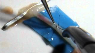 Микрососудистый анастомоз Microvascular anastomosis [upl. by Bilow]