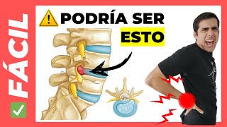 💥 HERNIA DE DISCO ¿Qué es SINTOMAS  Lumbar Cervical [upl. by Barthelemy513]