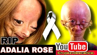 ADALIA ROSE WILLIAMS fallece la Youtuber influencer sufría Síndrome de Progeria HutchinsonGilford [upl. by Wyatan]