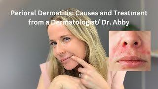 Perioral dermatitis causes and treatment from a Dermatologist [upl. by Oek]