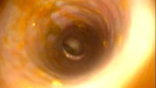 VeterinaryColonoscopy from a dog normal fully wwwenendovetsu [upl. by Marchelle]