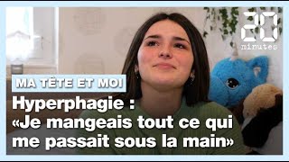 Hyperphagieboulimique  «Je mangeais tout ce qui me passait sous la main» [upl. by Vivienne]