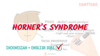 Horners syndrome pathophysiology  Neuroaholics [upl. by Sibyls919]