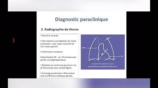 Cours de Cardiologie Rétrécissement Aortique [upl. by Holmes]