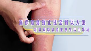 濕疹痕癢難止抓至難以入眠 新型藥助患者重掌生活主導權 [upl. by Ursas]