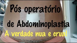 Pós operatório de Abdominoplastia lipoaspiração e enxerto de glúteo  dicas [upl. by Nesaj57]