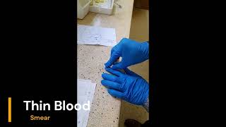 malaria Invivo BALBc Mice Experiment Part 1 [upl. by Ilyk]