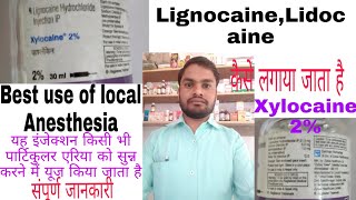 Xylocaine 2 injection की पूरी जानकारी हिंदी में यह इंजेक्शन सुन्न करने के लिए यूज किया जाता है [upl. by Owades]